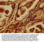 GABARAPL2 Antibody