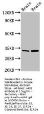 HAX1 Antibody