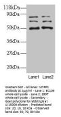 VOPP1 Antibody