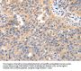 IRS2 Antibody