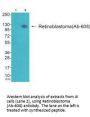 RB1 (Ab-608) Antibody