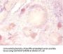 PARK7 Antibody