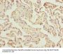 RAD23A Antibody