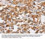 DKK3 Antibody
