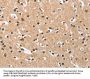 DKK3 Antibody
