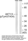 Phospho-AKT1/AKT3 (Tyr437/434) Antibody