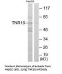 NGFR Antibody