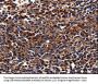 ADRB1 Antibody