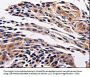 ADRB1 Antibody