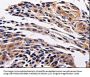 ADRB1 Antibody