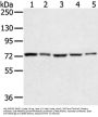 TGM4 Antibody