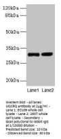 UQCRQ Antibody
