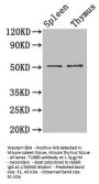 TUBB3 Antibody