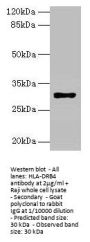 HLA-DRB4 Antibody