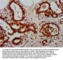 RELA Antibody