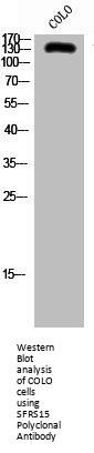 SCAF4 Antibody