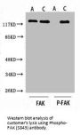 Phospho-PTK2 (S843) Antibody