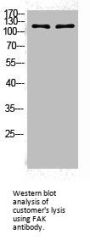 PTK2 Antibody