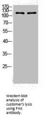 PTK2 Antibody