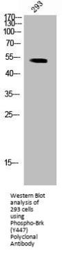 Phospho-PTK6 (Y447) Antibody