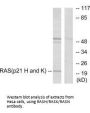 RASH/RASK/RASN Antibody