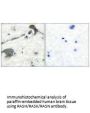 RASH/RASK/RASN Antibody