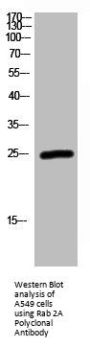 RAB2A Antibody