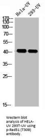 Phospho-RAD51 (T309) Antibody