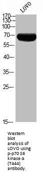 Phospho-RPS6KB1 (T444) Antibody