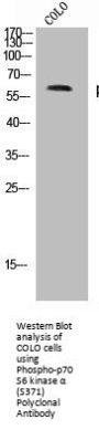Phospho-RPS6KB1 (S371) Antibody