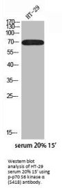 Phospho-RPS6KB1 (S418) Antibody