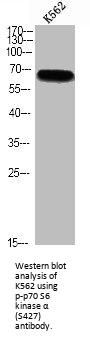 Phospho-RPS6KB1 (S427) Antibody