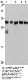 Rabbit anti-human NUP62 polyclonal antibody