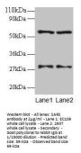 SARS Antibody