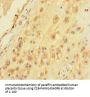 SARS Antibody