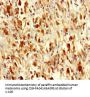 SARS Antibody