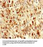 SARS Antibody