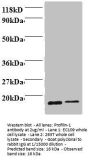 PFN1 Antibody