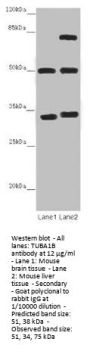 TUBA1B Antibody