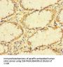 TUBA1B Antibody