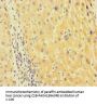 TUBA1B Antibody