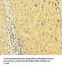 TUBA1B Antibody