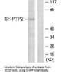 PTPN11 Antibody