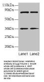 HNRNPH1 Antibody