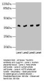 TALDO1 Antibody