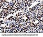 ALOX5 Antibody