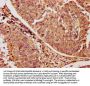 RAC1 Antibody