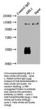 ABL1 Antibody
