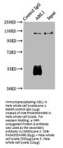 ABL1 Antibody