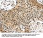 PLIN3 Antibody